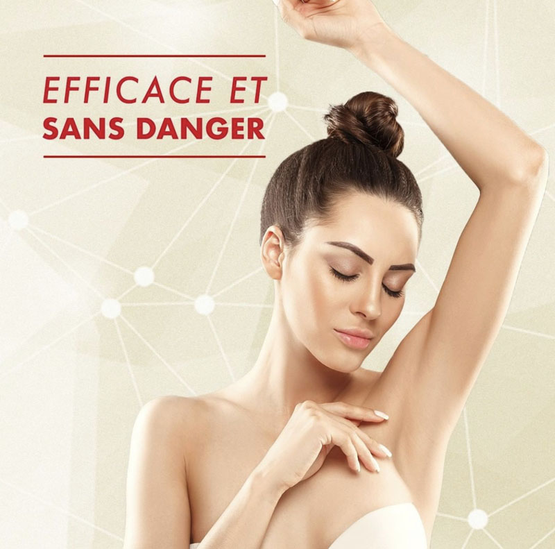 epilation definitive