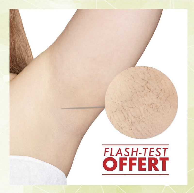 epilation definitive